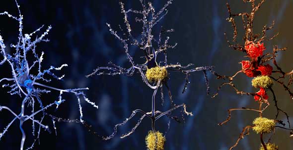 Neurological Biomarkers