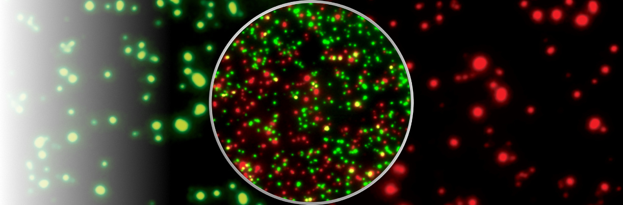 EliSpot  (Enzyme linked immunosorbent spot assay) & iSpot