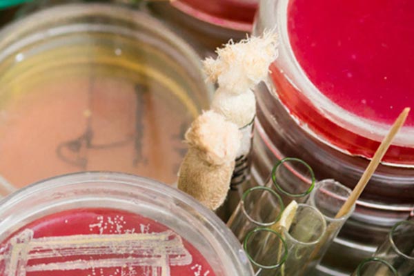 Foodborne pathogens