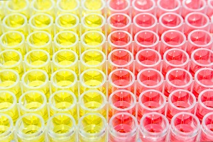 Enzyme linked immunosorbent assay (ELISA) is the most widely used type of immunoassay. 